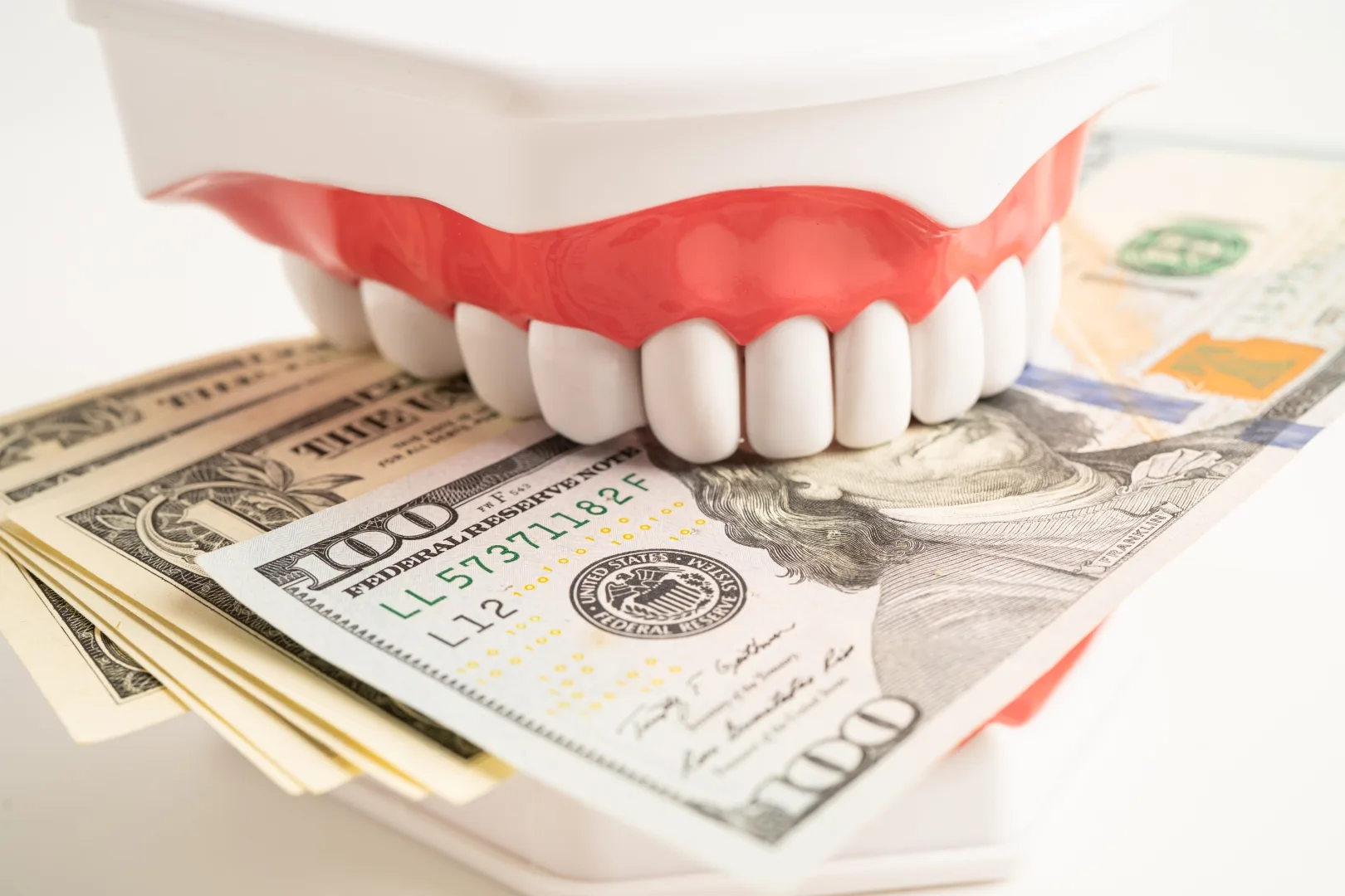 Stuart FL Dental Implants Cost Dental Implants Cost Stuart FL