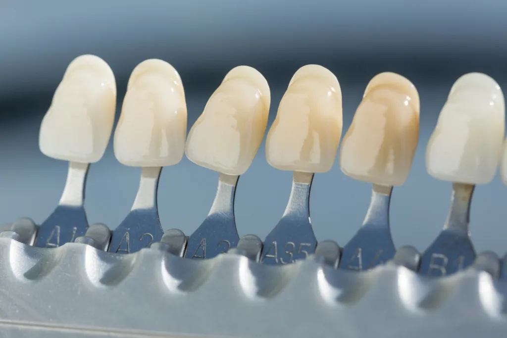 the difference between dental implants and dentures
