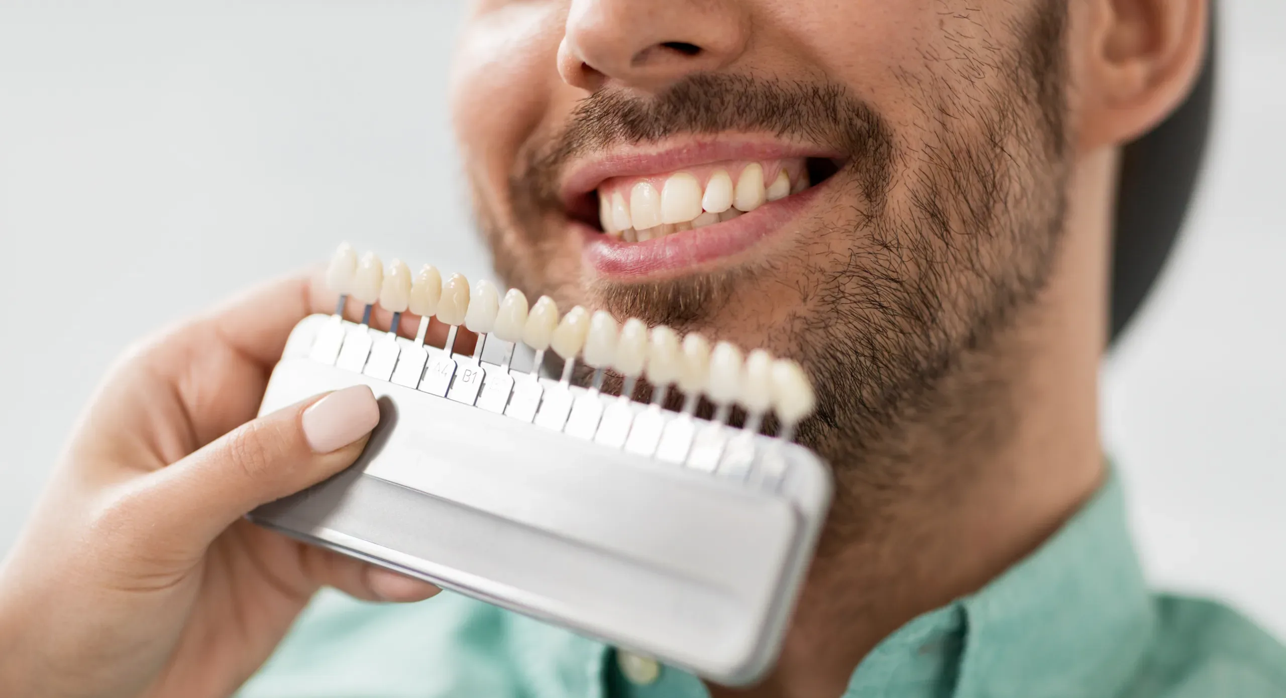 Dental Veneers Stuart FL stuart fl dental veneers