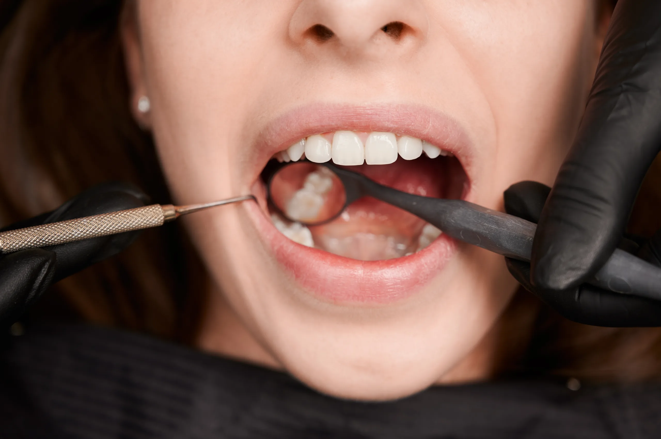 female smile with white healthy teeth